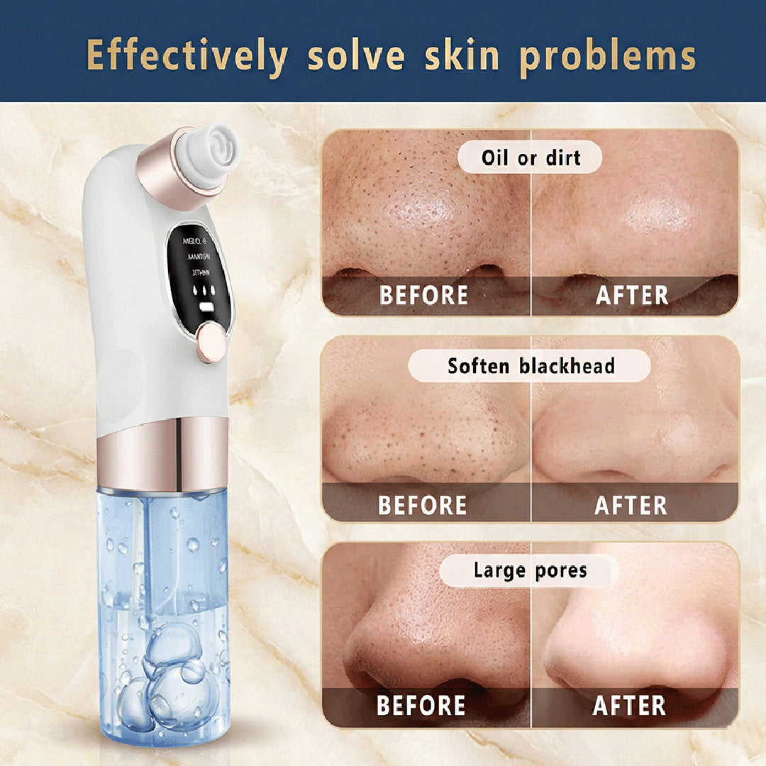 BXA Electric Blackhead Remover Pore Vacuum | USB Rechargeable Water Cycle Face Cleaner